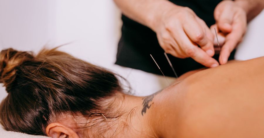 Acupuncture costs about $75 to $150 per session in 2026