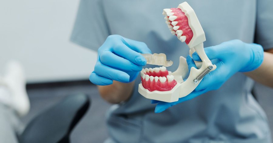 A dental bridge costs $3,010 to $7,900 in 2026
