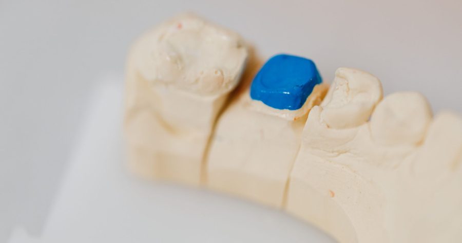 A dental crown costs $1,015 to $2,670 per tooth in 2026
