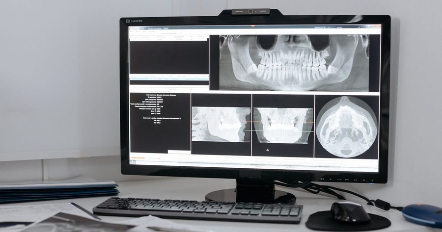 A full set of dental X-rays costs $125 to $335 in 2026