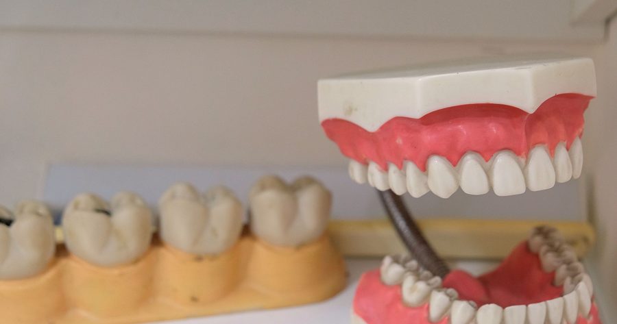 Dentures cost about $2,000 per arch in 2026