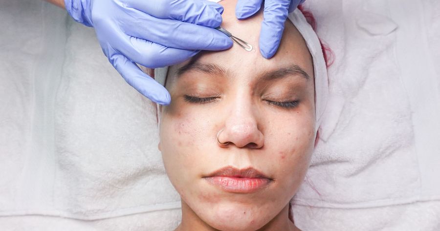 Dermaplaning costs about $75 to $250 per session in 2026