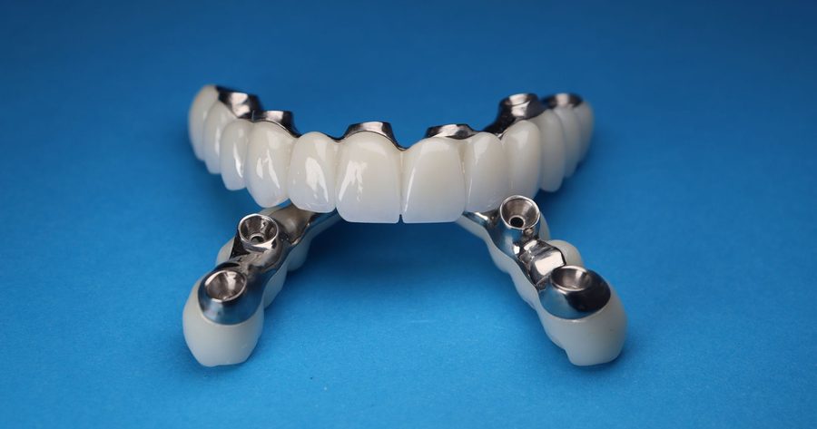 Full mouth dental implants cost $14,700 to $38,600 per arch in 2026