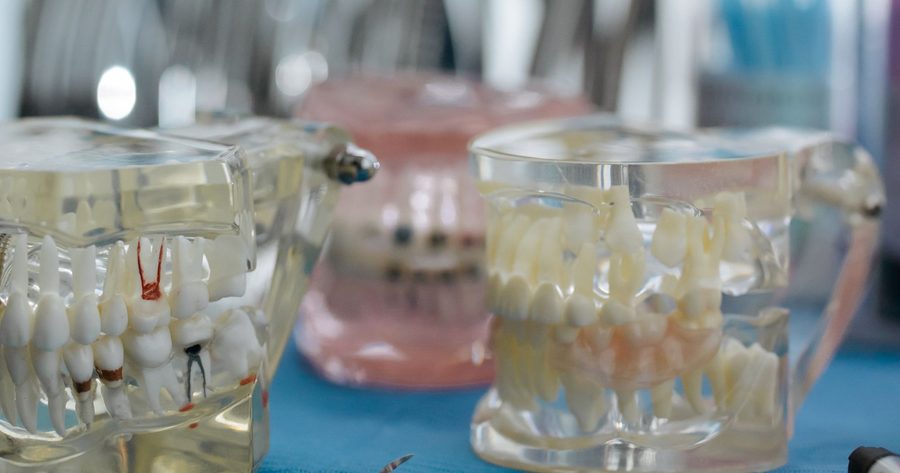 An inlay or onlay costs $635 to $1,665 per tooth in 2026