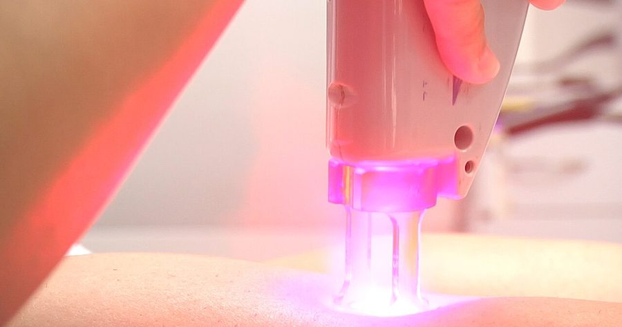 Laser hair removal costs $200 to $500 per session in 2026