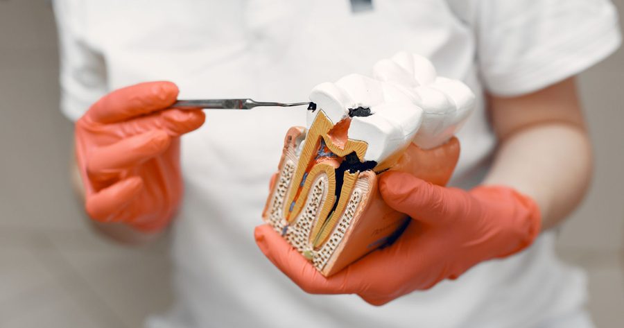 A molar root canal costs $685 to $1,800 in 2026