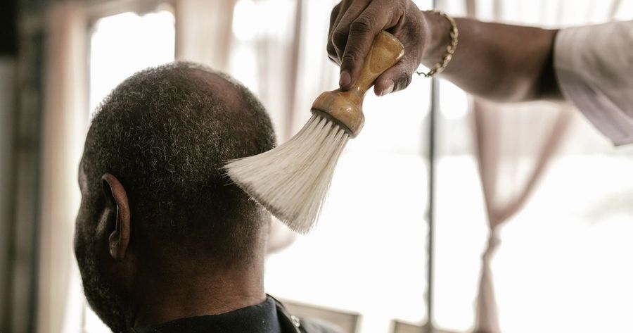 Scalp micropigmentation costs about $2,000 to $5,000