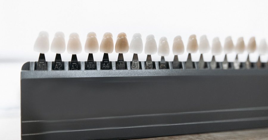 Veneers cost $930 to $2,440 per tooth in 2026